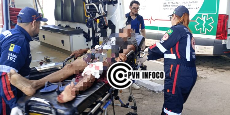 Grave Acidente com Motosserra Fere Homem em Sítio na BR-319