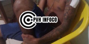 Apenado Monitorado Sofre Tentativa de Homicídio em Porto Velho e Atribui Ataque a Rivalidade de Facções