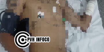 Jovem é baleado durante tentativa de latrocínio na zona leste de Porto Velho