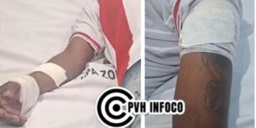 Jovem é baleado após tentativa de homicídio no bairro JK em Porto Velho