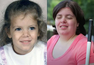 Mulher Aplica Produto Químico nos Olhos para Realizar Desejo de Ficar Cega